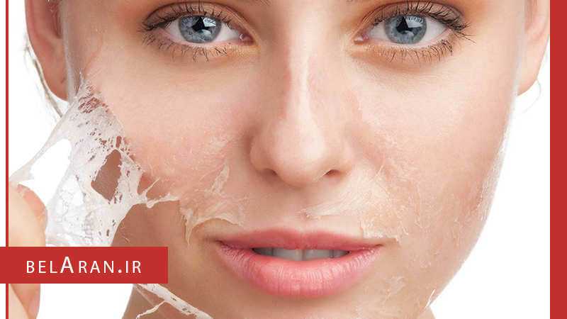 اسکراب پوست و نکاتی که لازم است در مورد آن بدانیم - بلاران