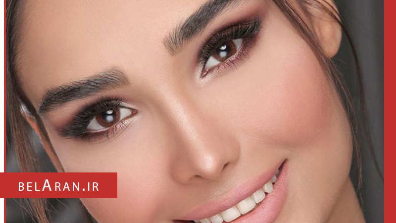 انواع فیکساتور را بشناسیم - بلاران