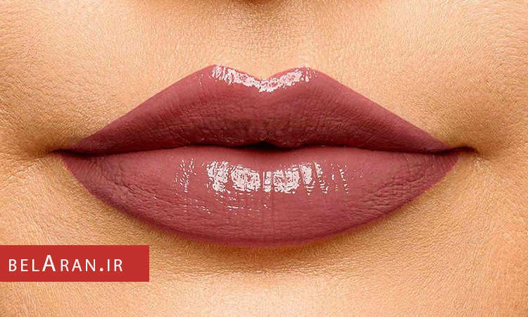 انواع برق لب و روش استفاده از آن - بلاران