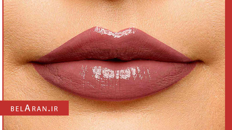 انواع برق لب و روش استفاده از آن - بلاران