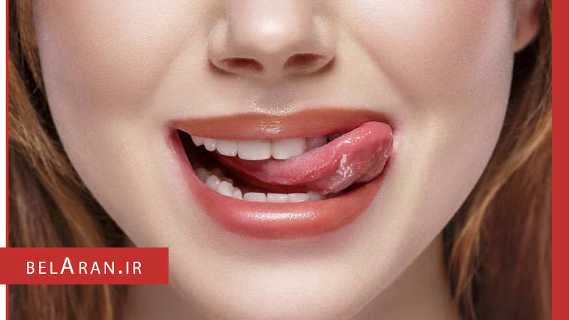 علل خشکی لب ها و ترک خوردن آن ها را بدانیم - بلاران