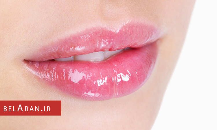 خشکی و ترک لب ها و روش های ساده ای برای از بین بردن آن - بلاران