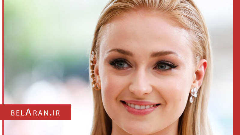 داشتن چهره ای جوان تر با آرایش موی مناسب - بلاران