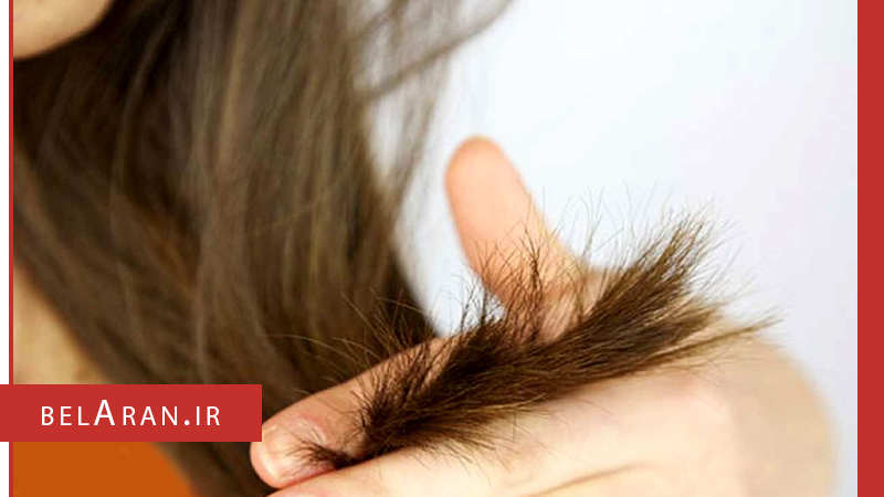 استفاده کردن اتوی مو چه عوارض و عواقبی را در پی دارد؟ - بلاران