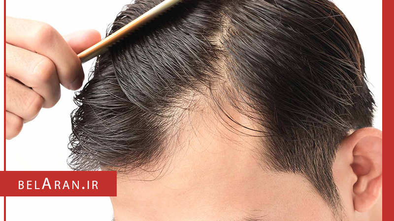 آیا عوارض صاف کردن موها را با استفاده از ابزارهای حرارتی می دانید؟ - بلاران