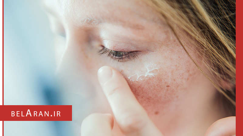 خشکی پوست و علل بوجود آمدن آن - بلاران