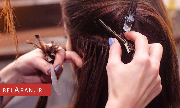 با ویژگی ها و مزایای اکستنشن لیزری بیشتر آشنا شوید - بلاران