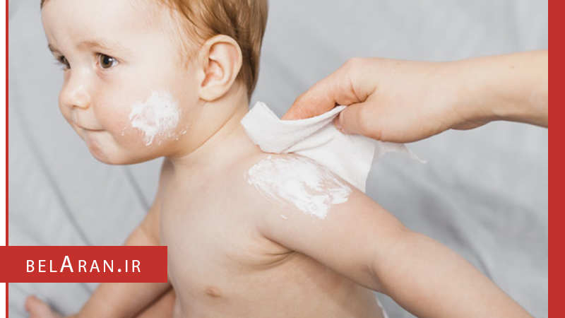 شناخت انواع لوسیون بدن و کارایی آن ها بر روی پوست - بلاران