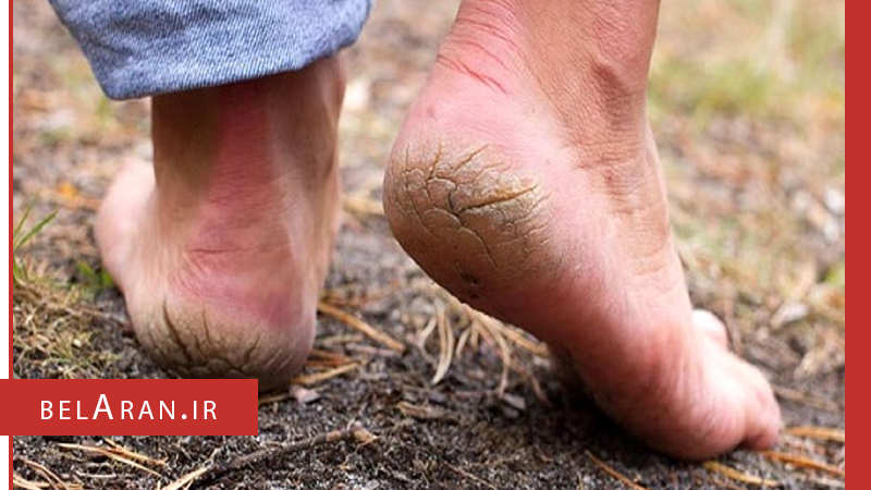 مزایا و فواید لوسیون بدن را بدانیم - بلاران