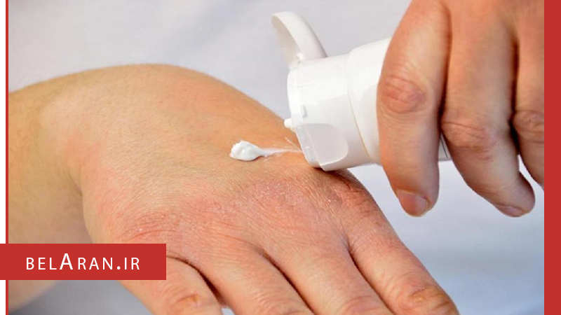 لوسیون بدن چیست و چه کاربردی برای بدن دارد؟ - بلاران