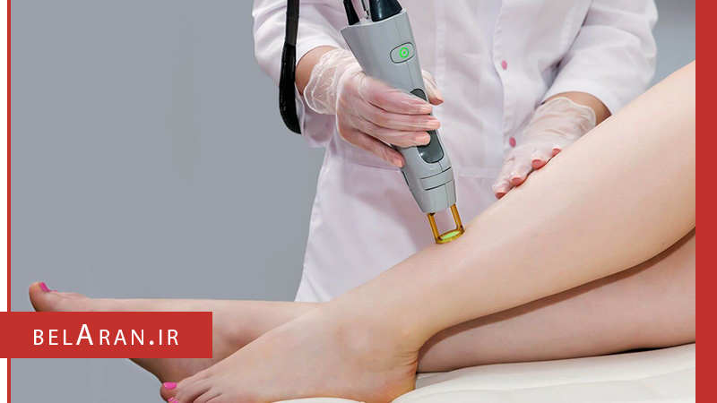 شناخت روش هایی برای رفع دائمی موهای زائد بدن - بلاران