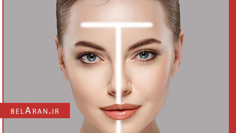 آیا در مورد تی زون صورت چیزی می دانید؟ - بلاران