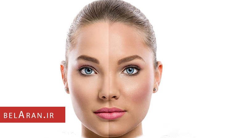 آیا روشن شدن پوست با مواد طبیعی امکان پذیر است؟ - بلاران