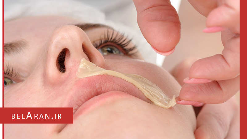وکس کردن موهای زائد و چگونگی انجام آن - بلاران