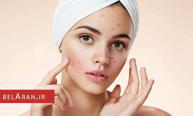 آیا می خواهید روش های طبیعی را برای درمان جوش های بعد از اصلاح امتحان کنید؟ - بلاران