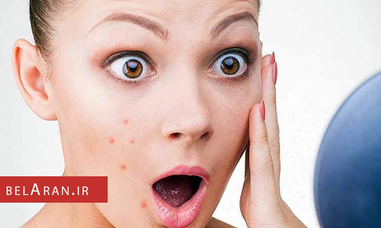 جوش های بعد اصلاح صورت را چگونه درمان کنیم؟ - بلاران