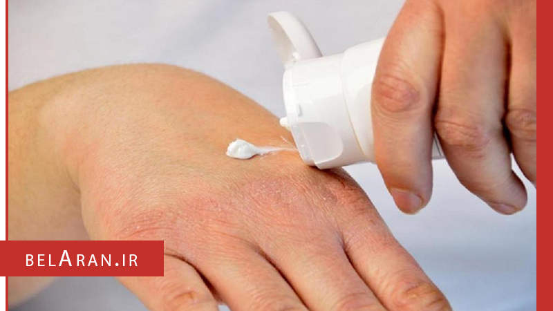 معرفی راه هایی برای درمان خشکی پوست دست - بلاران