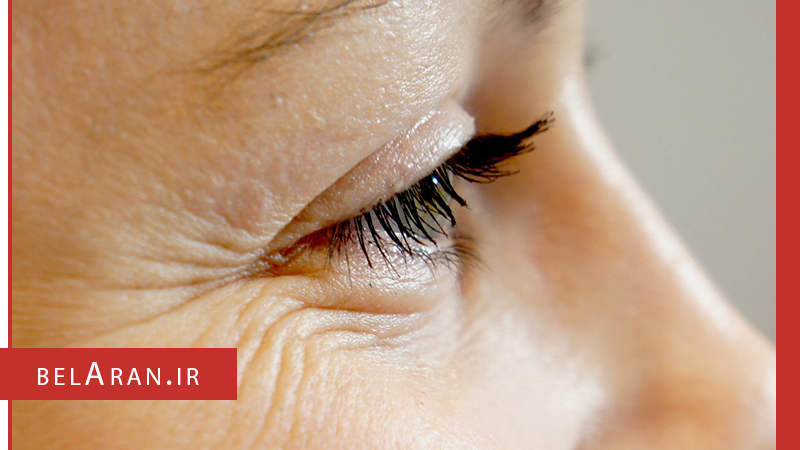 عوارض مصرف بیش از حد تونر پوست را هم بدانیم - بلاران