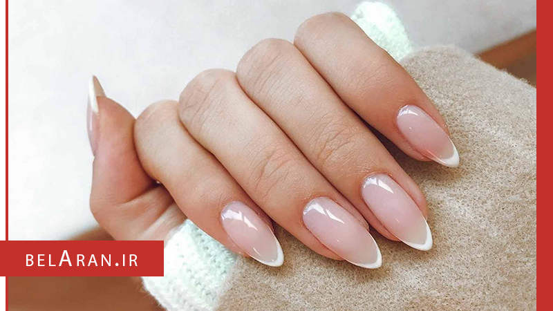 ناخن - بلاران