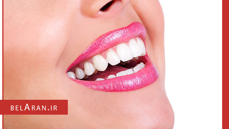 لایه برداری لب ها با چند روش طبیعی و آسان - بلاران