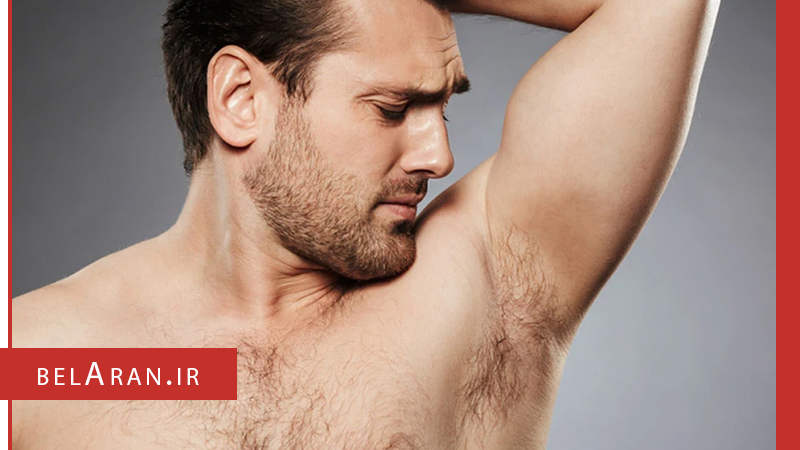 علل و عوامل تیرگی زیر بغل و شناخت راهکارهایی برای آن -بلاران