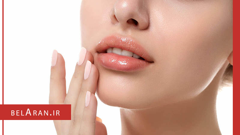 لب های زیبا - بلاران