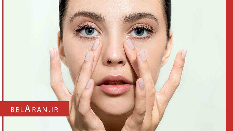 پوست دور چشم - بلاران