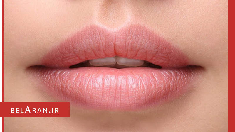 رنگ طبیعی لب ها با بکار بستن این راهکارها - بلاران