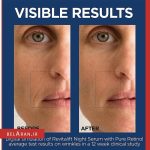 سرم شب ضدچروک لورال رویتالیفت لیزر رتینول-بلاران LOreal Revitalift Laser Pure Retinol Deep Anti-Wrinkle Night Serum