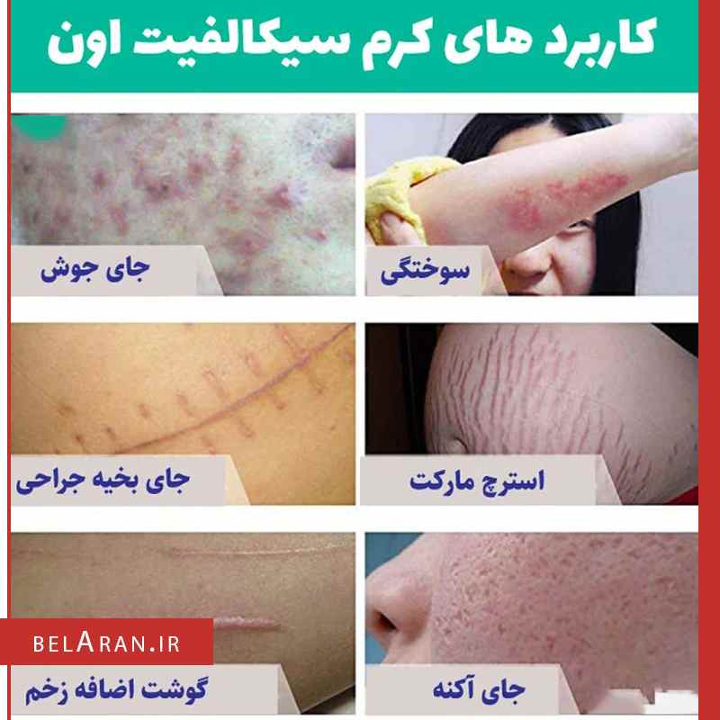 کرم ترمیم کننده پوست سیکالفیت پلاس اون-بلاران-index_belaran کرم ترمیم کننده پوست سیکالفیت پلاس اون-بلاران AVENE Cicalfate+ Repairing Protective Cream