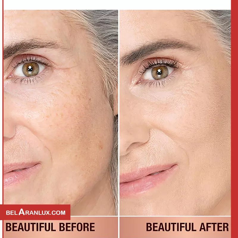 کرم پودر پوست زیبای شارلوت تیلبری-اسکین تینت شارلوت تیلبری-Charlotte Tilbury Beautiful Skin Foundation-لوازم آرایش لوکس-لوازم آرایش اورجینال-بلاران